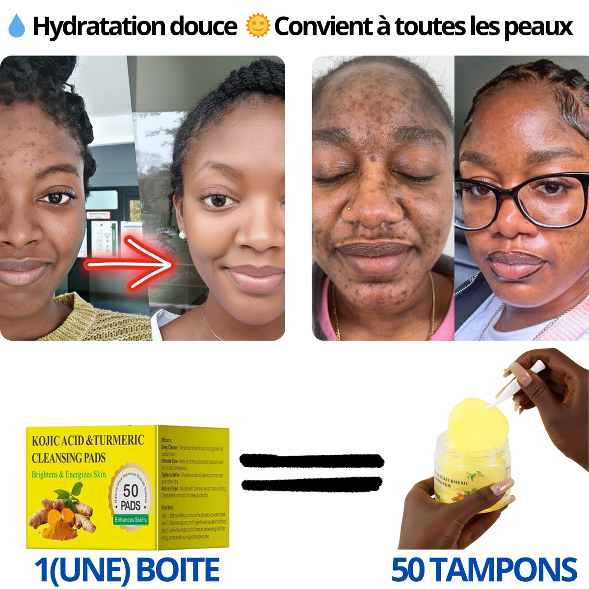 50 Patch de Curcuma: anti-bouton, eclat naturel